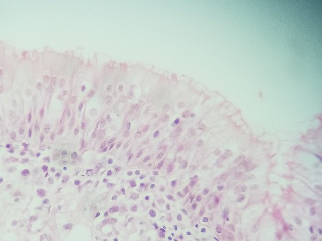 Pseudostratified Epithelium Slides - Pseudostratified Epithelium 11 400X
